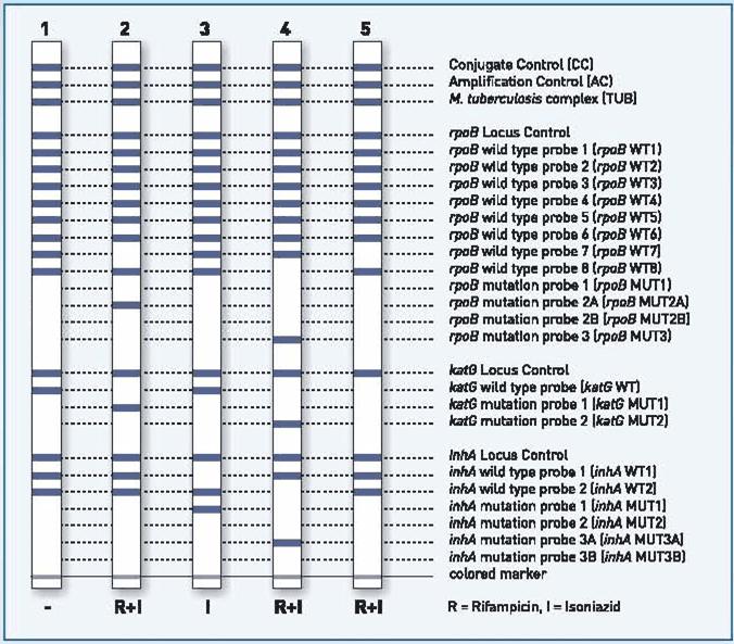 Line Probe Assays GenoType MTBDRplus assay (Hain Lifesciences) Excellent