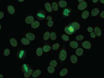 gecondenseerd chromatine in de mitose cellen