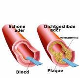 Dia 7 Verzadigde vetten Veel afkomstig van dierlijk voedsel. Ongunstig effect op cholesterolgehalte.