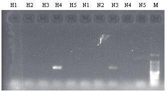 De sequenties van deze fragmenten werden later bepaald. Met For en Rev primers werden de sequentie bepaald, in totaal 16 reacties) Figuur 1. Gezuiverde PCR producten (ca.