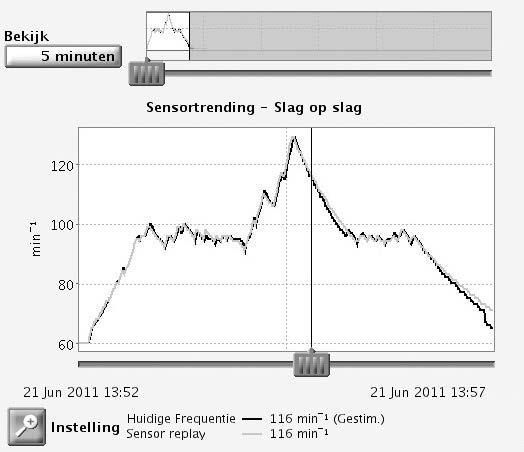 STIMULATIETHERAPIEËN FREQUENTIE ADAPTERENDE STIMULATIE EN SENSORTRENDING 4-47 Sensortrending Deze functie is beschikbaar bij AUTOGEN-, DYNAGEN-, INOGEN-, ORIGEN-, INCEPTA-, ENERGEN-, PUNCTUA- en