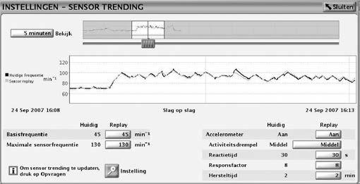 Sensortrending biedt een grafische weergave van de frequentierespons van de waargenomen fysiologische vraag van de patiënt en biedt nuttige informatie tijdens het testen van inspanning.