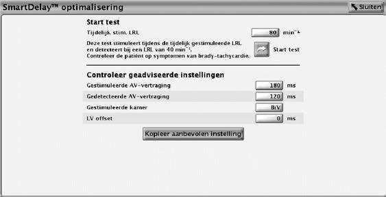 4-70 STIMULATIETHERAPIEËN AV-INTERVAL Figuur 4 41. Scherm SmartDelay optimalisering OPMERKING: Tijdens de uitvoering van de test is tachytherapie uitgeschakeld.