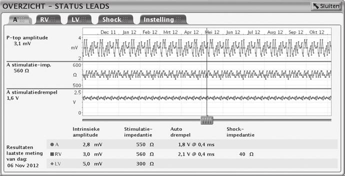 5-10 SYSTEEMDIAGNOSTIEK LEADSTATUS [1] Gebruik de tabbladen om de juiste lead te selecteren [2] Resultaten voor de geselecteerde dag [3] Resultaten voor de meest recente dag [4] Y-as past zich aan op