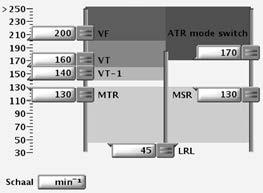 DETECTIE VAN TACHYARITMIE HET BEREKENEN VAN FREQUENTIES EN REFRACTAIRE PERIODEN 2-5 Bij beslissingen betreffende cardiale resynchronisatie- en bradycardietherapie wordt de detectie van de frequentie