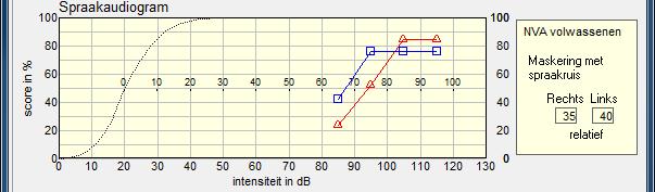 Verschuiving van de curve > verbetering Let op: Vrije veld curve is ca 5dB gunstiger dan meting hoofdtelefoon