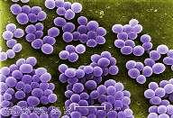 Staphylococcus aureus Staphylo coccus aureus - Grieks: σταφυλή = druiventros -