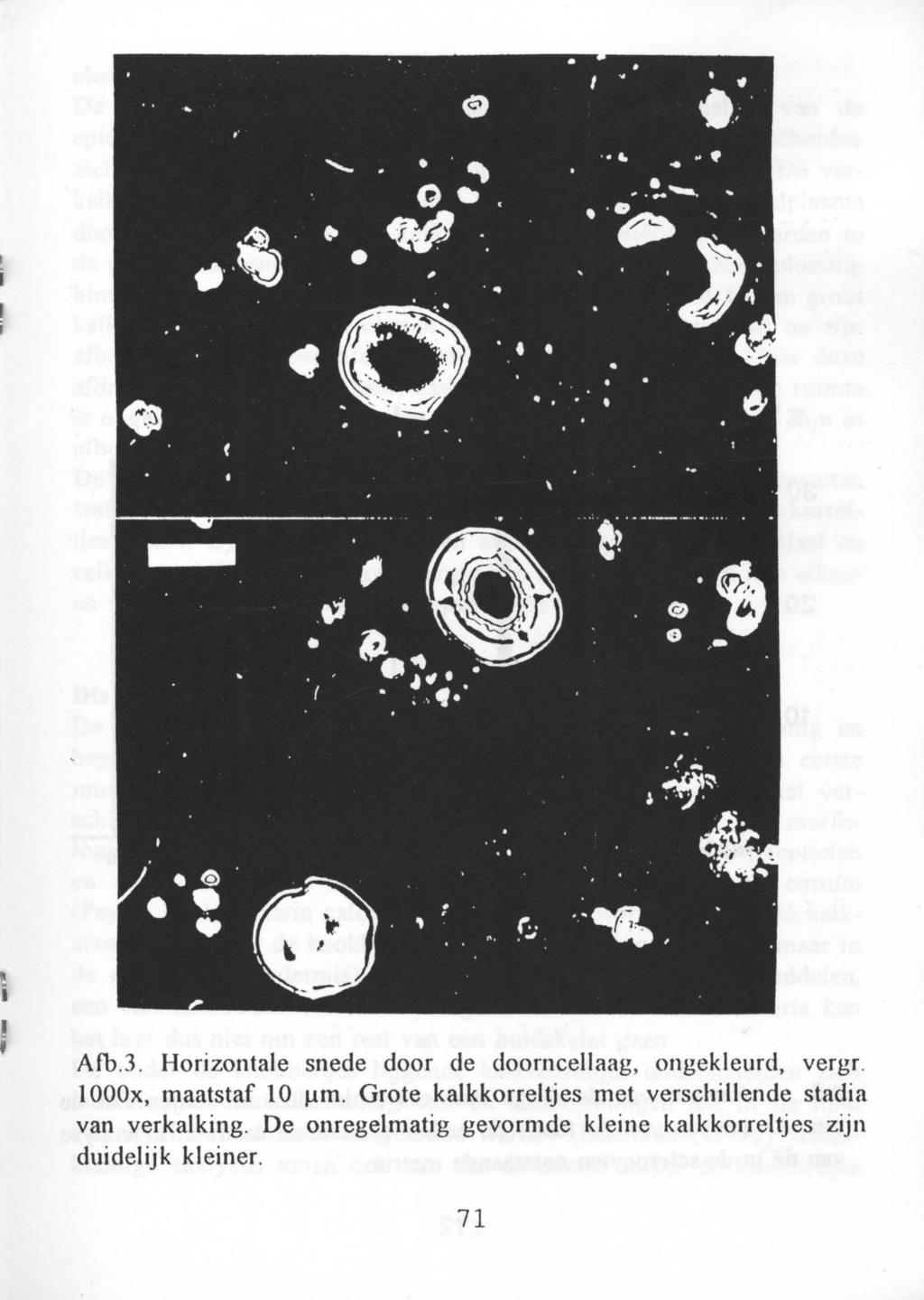 Afb.3. Horizontale snede door de doorncellaag, ongekleurd, vergr. 1000x, maatstaf 10 Ilm.