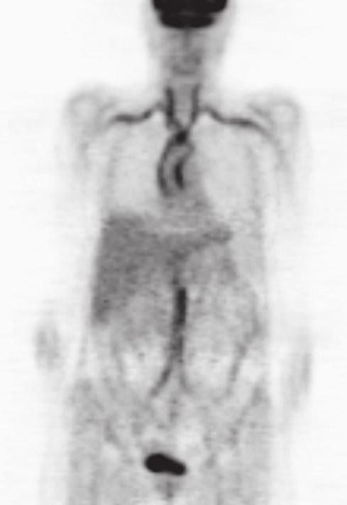 hersenen A. carotis communis A. subclavia arcus aortae aorta abdominalis A. iliaca communis urineblaas figuur 3.