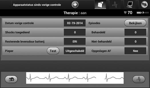 2-12 Protocol voor MRI-scanprocedures Na de scan OPMERKING: Indien nodig kan de MRI Beschermingsmodus ook met behulp van Reddingsshock worden afgesloten. Figuur 2 9.