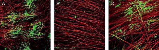 Professoren Dick Hoekstra De aanmaak van myeline in een kweekschaal (figuur A). De axonen (rood) van neuronen zijn omgeven door myeline (groen), gemaakt door de aanwezige oligodendrocyten.