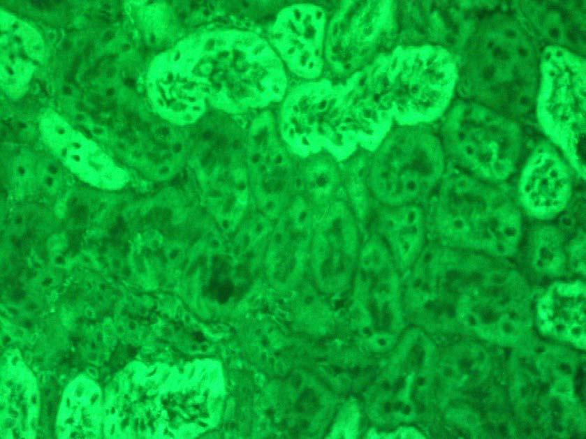 Liver Kidney Microsomes nier/maag/lever (rat of muis) Nier: diffuse en homogene cytoplasmatische fluorescentie van de proximale tubuli (niet distale tubuli)