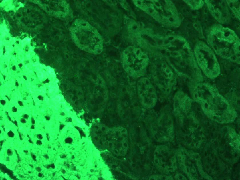 Liver Kidney Microsomes nier/maag/lever (rat of muis) Nier: diffuse en homogene cytoplasmatische fluorescentie van de proximale tubuli (niet distale tubuli)