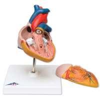 Het model toont 3 overbruggingen: naar de rechter coronaire arterie, naar de ramus interventricularis anterior