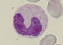 myeloïdematuratie neutrofiele staafkernigen (bandvorm)