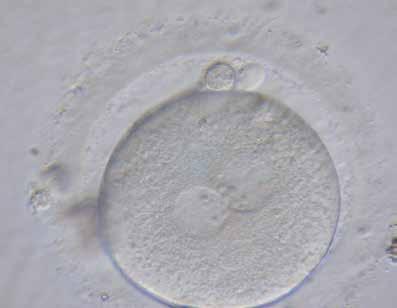 WETENSCHAPPELIJK ONDERZOEK 2 3 2 een rijpe eicel op dag 0 3 een bevruchte eicel op dag 1 Hieronder sommen we de rechten en (enkele) plichten op die u heeft als donor van menselijk reproductief