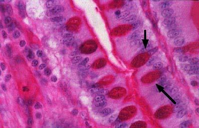 Zet de juiste namen bij de nummers. 1 = 2 = 3 = 4 = 7. Hier zie je een preparaat van de mucosa van de dunne darm. In de mucosa zitten niet alleen absorberende cellen.