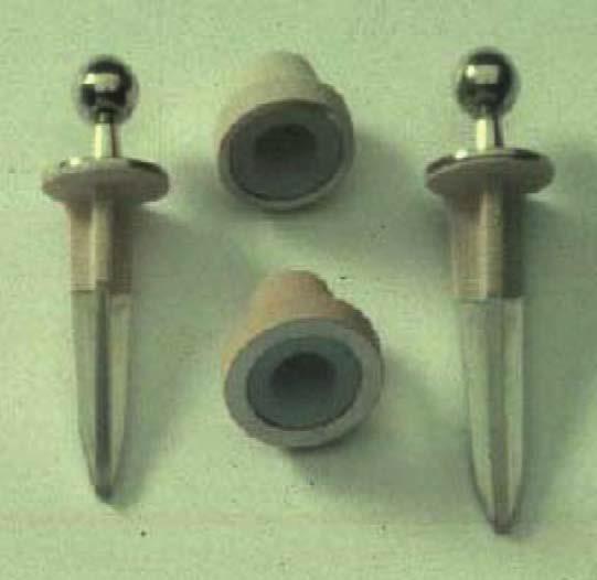 1.10. Roseland Inleiding De Roseland prothese werd voor het eerst ontwikkeld door 4 Franse chirurgen.