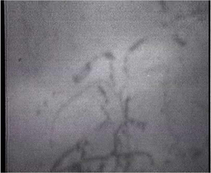 Microstructuur = defecten Dislocations 1D, lijndefecten Ongedeformeerd: 10 10 m 2, of 10 km per