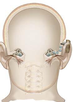 Als uw gehoorverlies veroorzaakt wordt door problemen in uw uitwendige oor of middenoor of als u éénzijdig doof bent, informeer dan bij uw audioloog of een botverankerd hoortoestel een oplossing voor