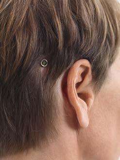 hoorhulpmiddelen Horen via beengeleiding; wat is het en voor wie? Chronische oorontstekingen aan haar enige horende oor leidden ertoe dat Jokelien (41) steeds slechter ging horen.