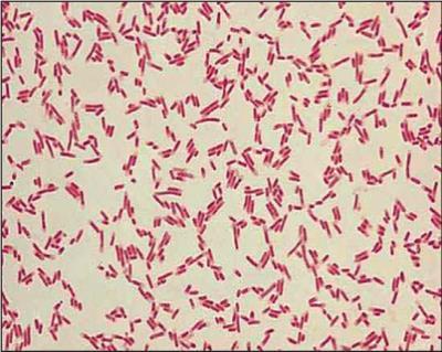 Uitstapje Pathogene E coli soorten Enterotoxinogenic E coli (ETEC) Enteroaggregative E Coli (EAEC) Diffuus adherente E coli (DAEC) Enterohemorraghische E coli: (EHEC) Shiga toxine