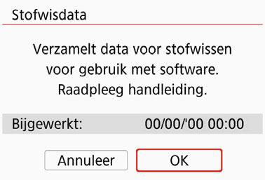 444) gebruikt de stofwisdata om stofvlekken automatisch te verwijderen. Voorbereiding Zorg voor een effen wit voorwerp, zoals een vel papier. Stel de brandpuntsafstand van de lens in op 50 mm of meer.