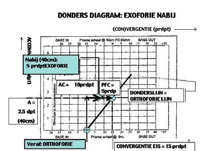 FORMULE AC/A FORIE= PD + Fn - Fa A Fn = Forie nabij (prdpt) Fa = Forie afstand (prdpt) ESO: (+) een esoforie krijgt een plus teken in de formule EXO: (-) een exoforie krijgt een min teken in de