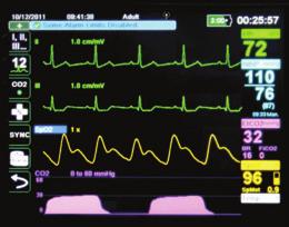 koolmonoxide en methemoglobine zijn verzekerd.