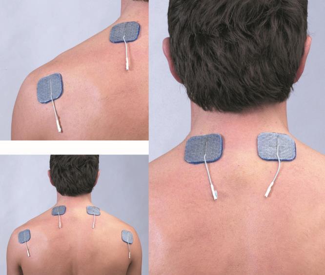 gebruik dan TENS op beide kanalen. TENS heeft ook invloed bij maagstoornissen via pijnpunten (triggerpoints) tussen de schouderbladen.