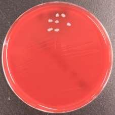 PATIENT 1 Ambulant, midstream en wbc 50/µl