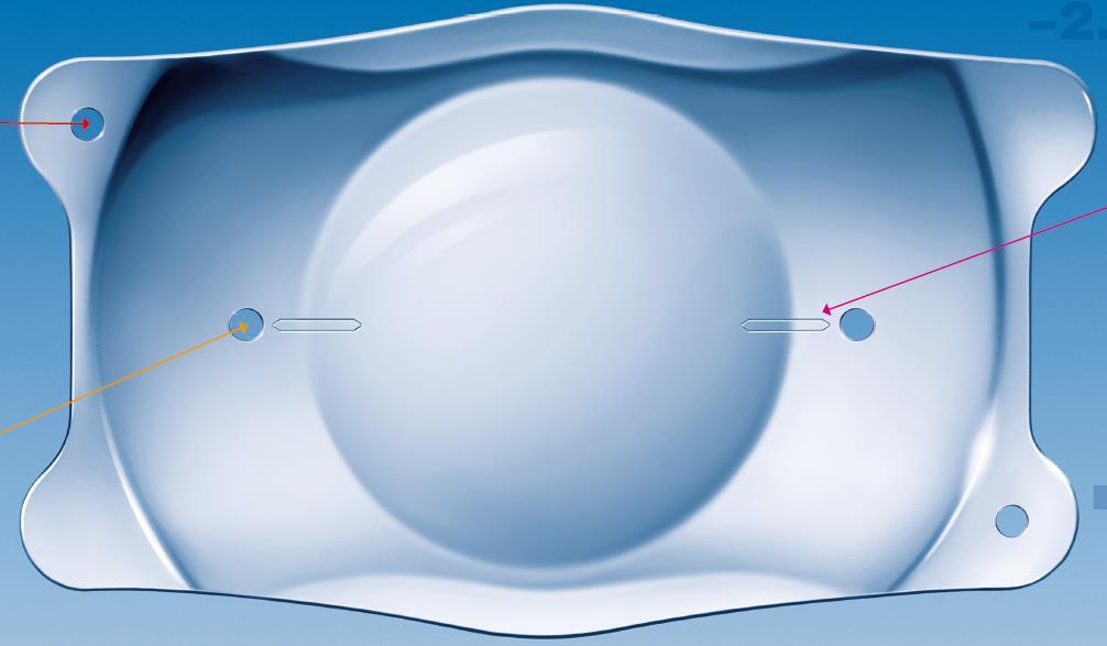 ICL De ICL is een ultradunne contactlens die geplaats kan worden in de ruimte tussen de eigen ooglens en het regenboogvlies.