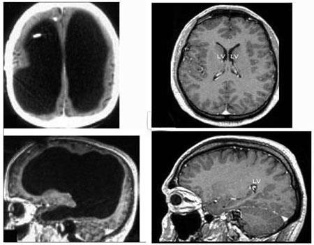 CT scan