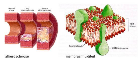 Observationale studies Fish/ omega-3 fatty acids and cognition in elderly Study design # studies Protective