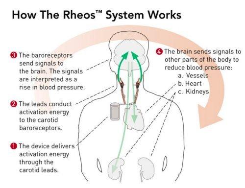 Nieuwe behandelingen BAT Rheos