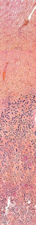 NIER 3, RAT, Alkalische fosfatase-kleuring cortex (schors) en medulla (merg) pyelum (bekken) 15 Aandachtspunten Dit preparaat leent zich bij uitstek om proximale tubuli te identificeren.
