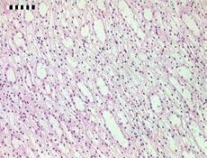 (merg), basis nierpyramide