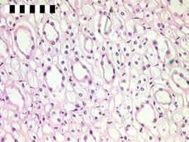 HE-kleuring 100 x G medulla