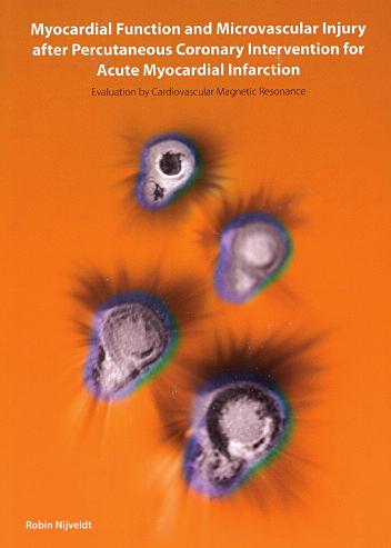 MEMORAD mededelingen Philipsprijs Beste Radiologische Proefschrift 2008 Hieronder treft u weer een overzicht aan van de ingezonden