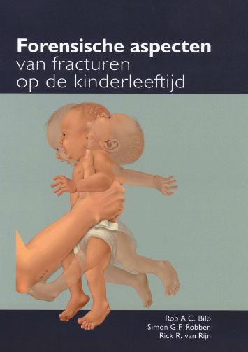 diversen BOEKBESPREKING Forensische aspecten van fracturen op de kinderleeftijd Rob A.C. Bilo, Simon G.F. Robben en Rick van Rijn 292 pagina s ISBN 9789074991582 Uitgever Isala series, Zwolle 2009 Het boek bestaat uit negen hoofdstukken over o.