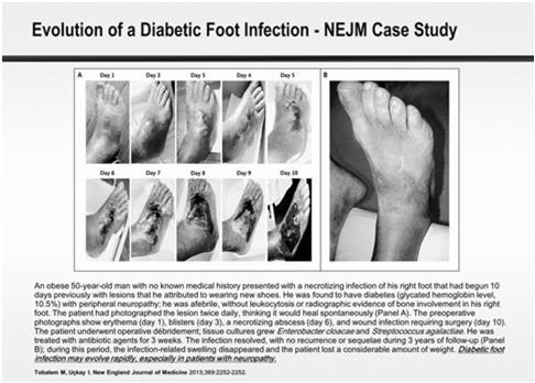 diabetes isminimised. These are: 1. Patient education 2.