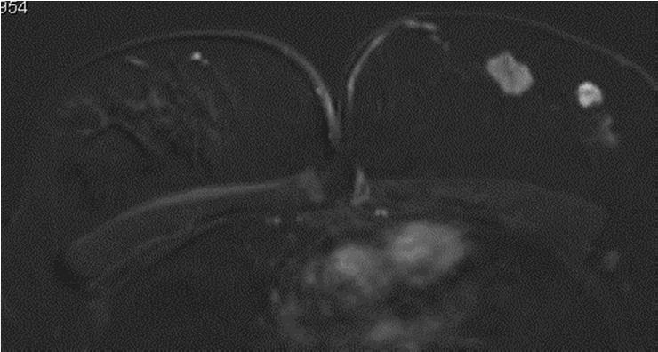 Moeten we allemaal MRI willen?