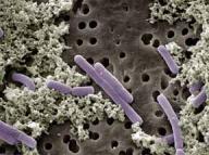 Bifidobacterium Strikt anaeroob, gram positief, niet sporenvormend, onbeweeglijk, Belangrijkste element in darmflora van babies (90%) Overigens alleen in darmflora Probiotisch