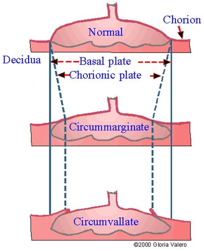 Placenta