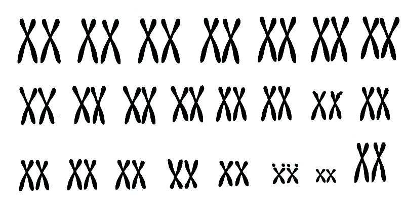 Lewenswetenskappe/V1 7 1.6 Die onderstaande diagramme toon die chromosoomstelle (kariotipes) van twee menslike individue, en. estudeer die diagramme en beantwoord die vrae wat volg.