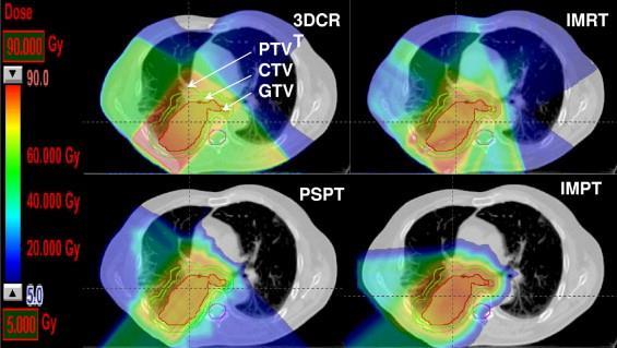 Scanning Beam Potential 21 Courtesy of J.