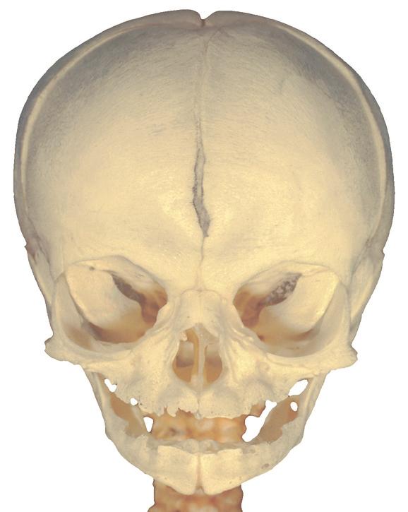 Schedel: osteogenese 1 2.1a c De schedel van een foetus (7 maanden oud), skelet-band-preparaat.