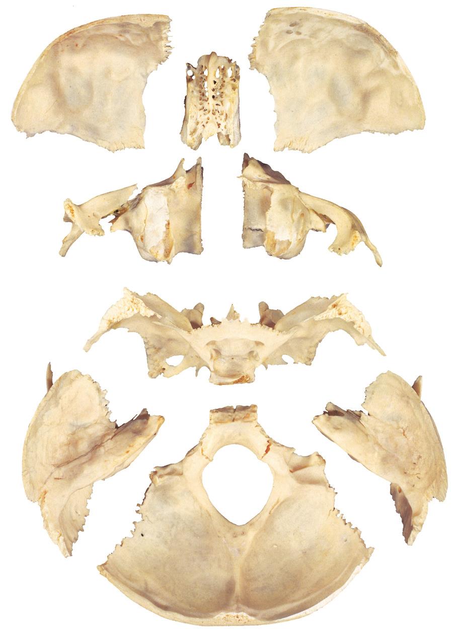 Schedelbasis: beenderen 2.10 Beenderen van de schedelbasis, aan de hand van een opengebroken schedel, bovenaanzicht.