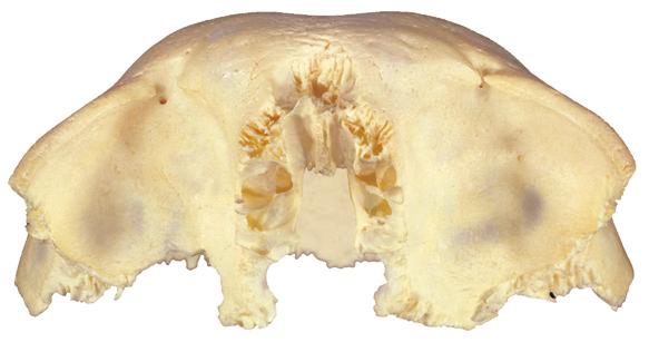 Incisura frontalis Glabella met restanten van de sutura frontalis = metopica Margo supraorbitalis a Vooraanzicht Fovea trochlearis