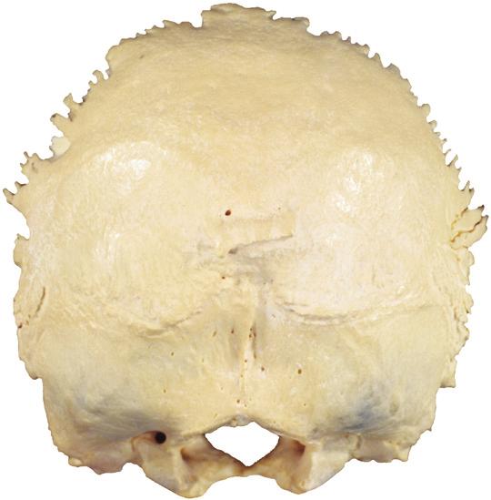 Achterhoofdsbeen 2.14a,b Achterhoofdsbeen (os occipitale).